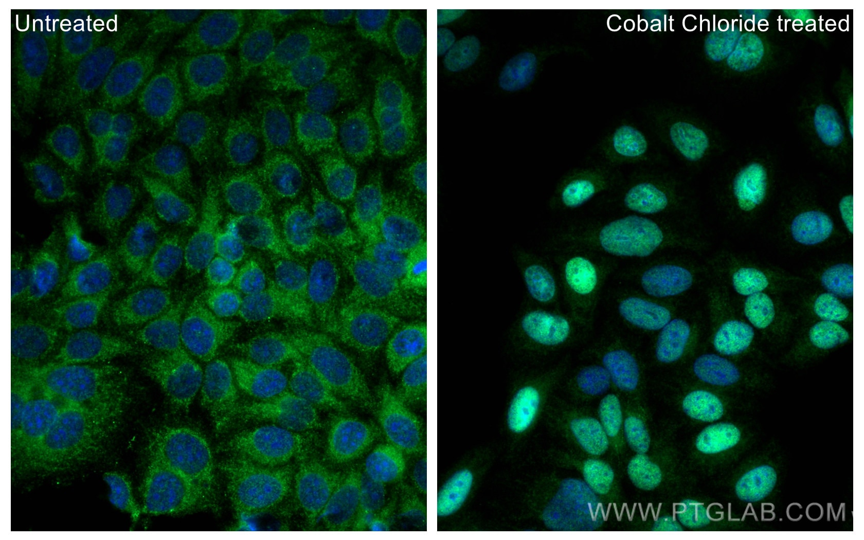 Immunofluorescence (IF) / fluorescent staining of HepG2 cells using HIF-1 alpha Polyclonal antibody (20960-1-AP)