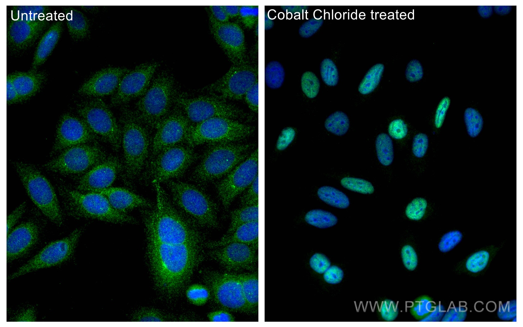 Immunofluorescence (IF) / fluorescent staining of HepG2 cells using HIF-1 alpha Polyclonal antibody (20960-1-AP)