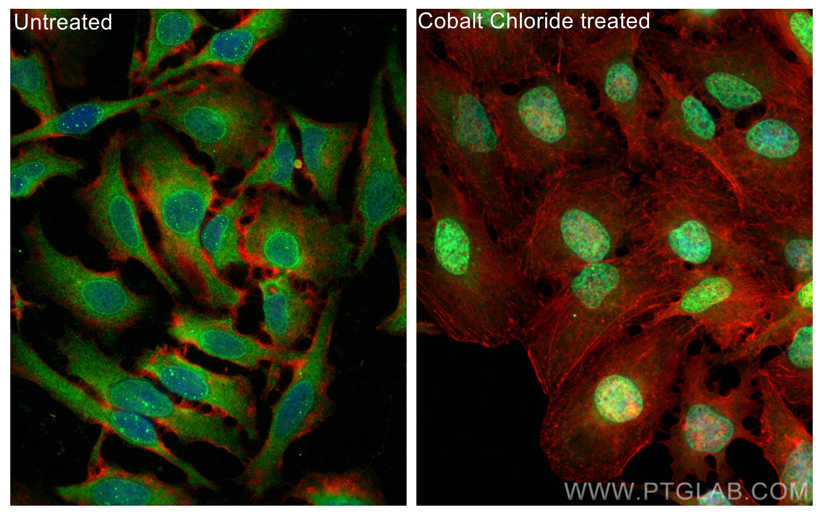 Immunofluorescence (IF) / fluorescent staining of HeLa cells using HIF-1 alpha Polyclonal antibody (20960-1-AP)