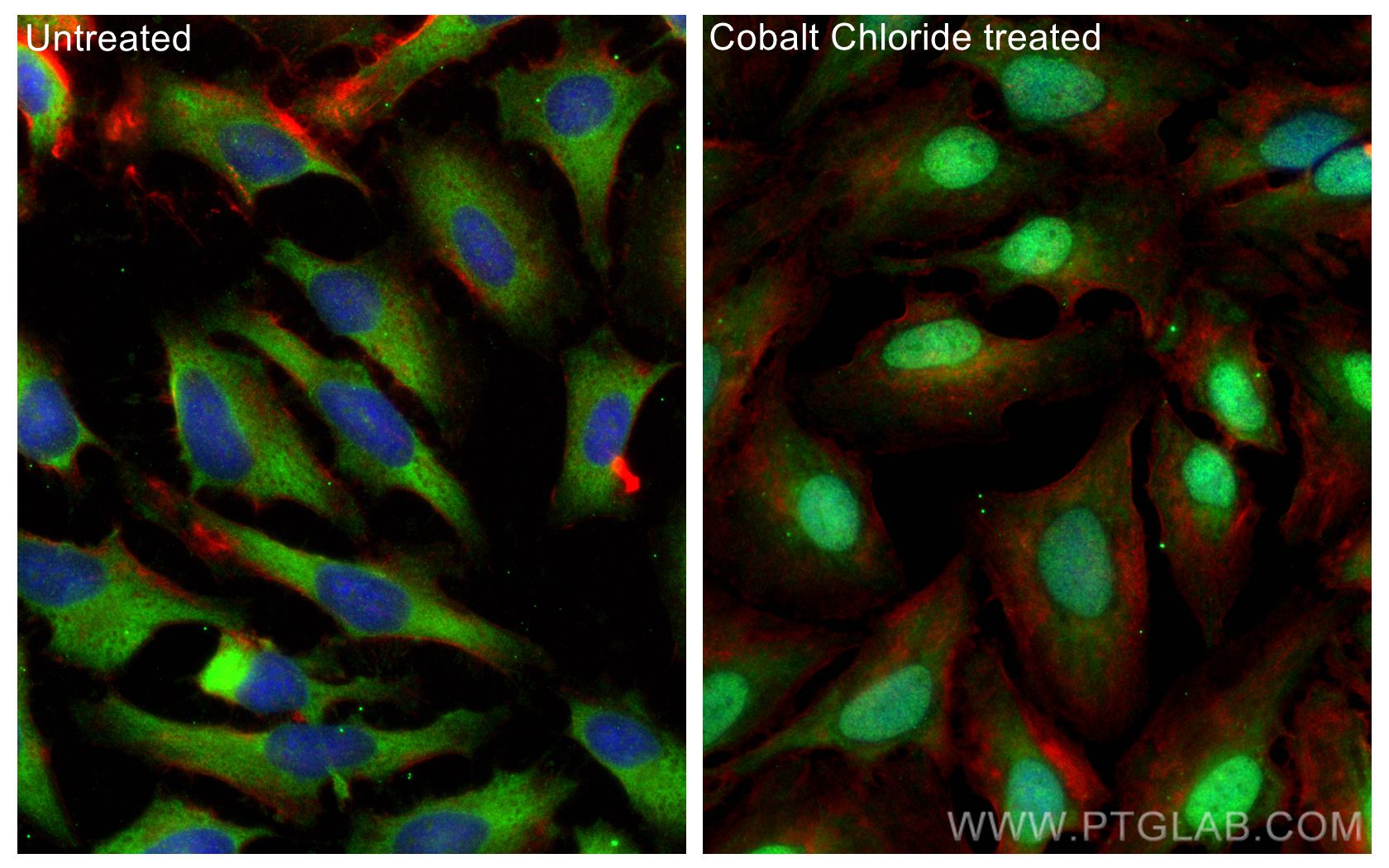 Immunofluorescence (IF) / fluorescent staining of HeLa cells using HIF-1 alpha Polyclonal antibody (20960-1-AP)