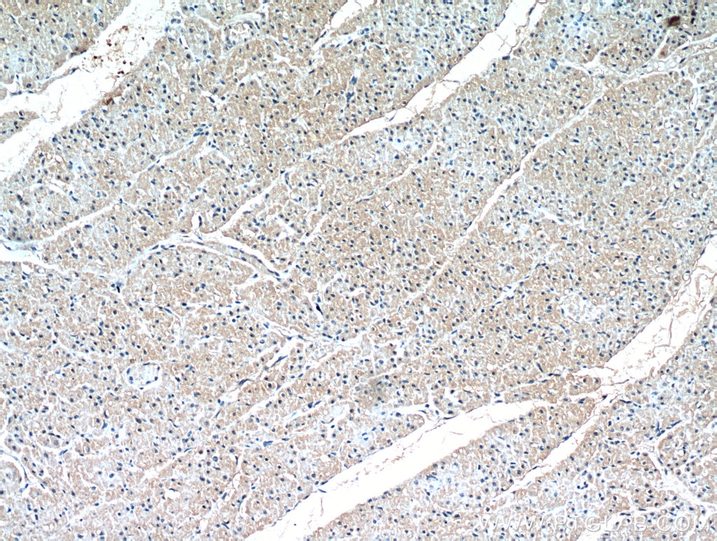 Immunohistochemistry (IHC) staining of human heart tissue using HIF1a Polyclonal antibody (20960-1-AP)