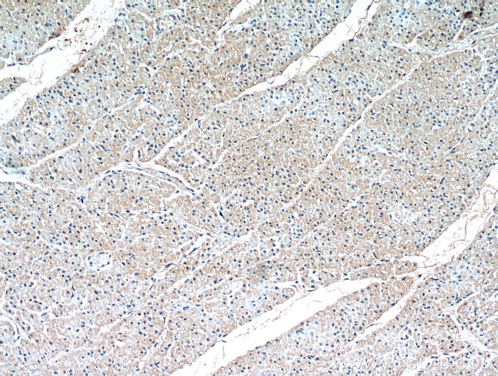 Immunohistochemistry (IHC) staining of human heart tissue using HIF-1 alpha Polyclonal antibody (20960-1-AP)