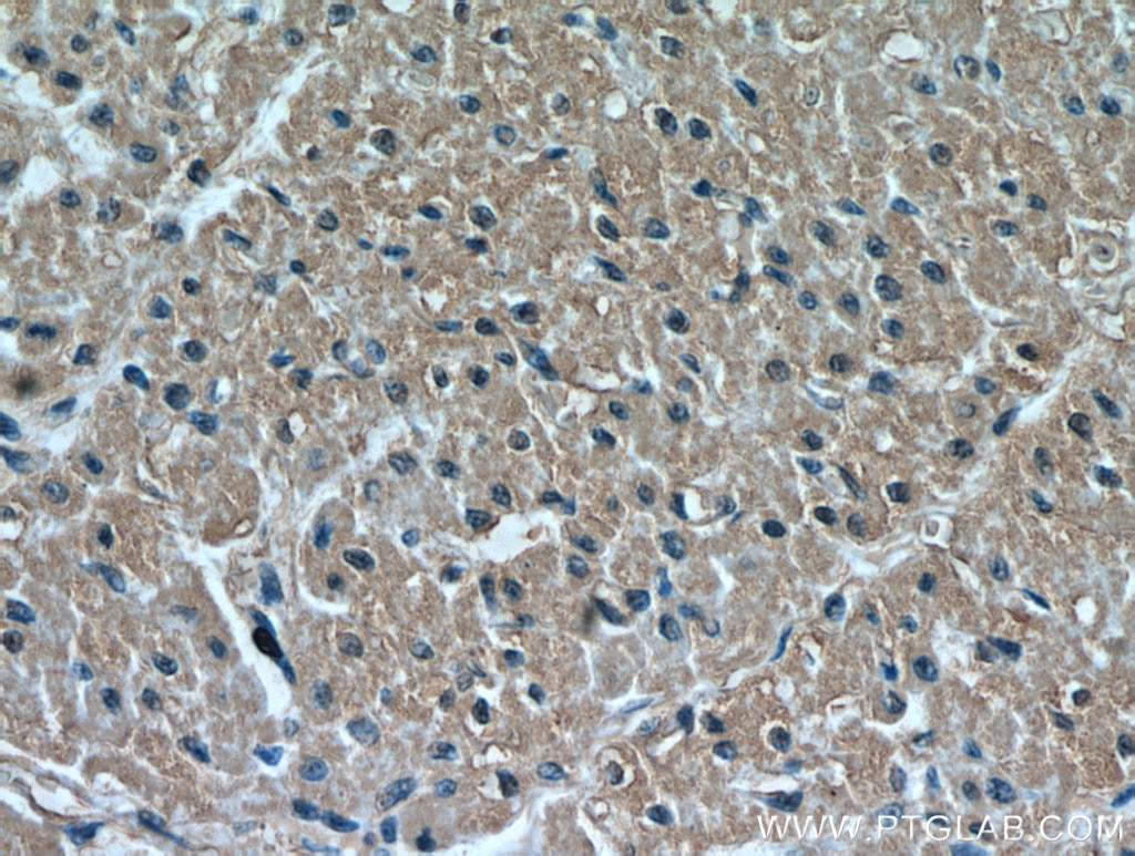 Immunohistochemistry (IHC) staining of human heart tissue using HIF-1 alpha Polyclonal antibody (20960-1-AP)