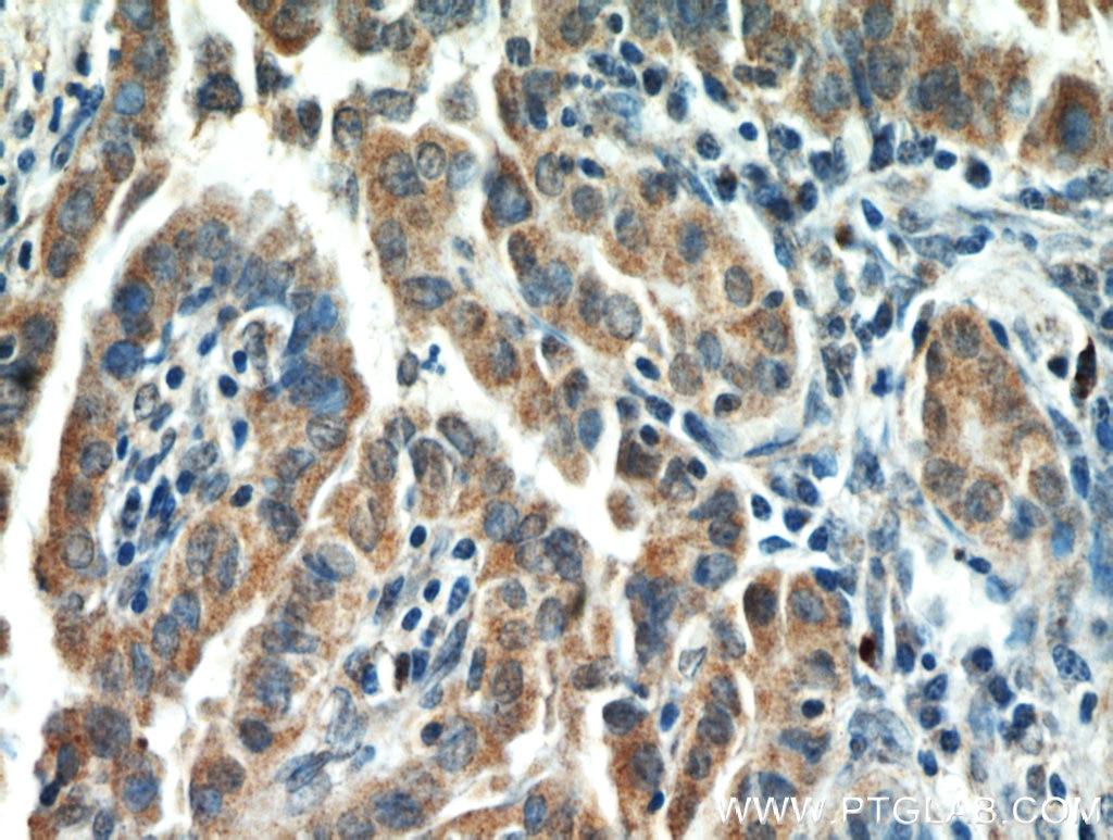 HIF-1 alpha Polyclonal antibody