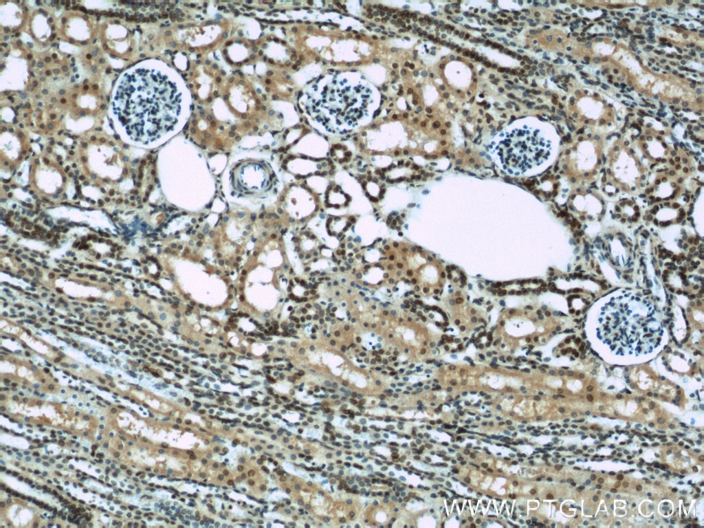 Immunohistochemistry (IHC) staining of human kidney tissue using HIF1a Polyclonal antibody (20960-1-AP)