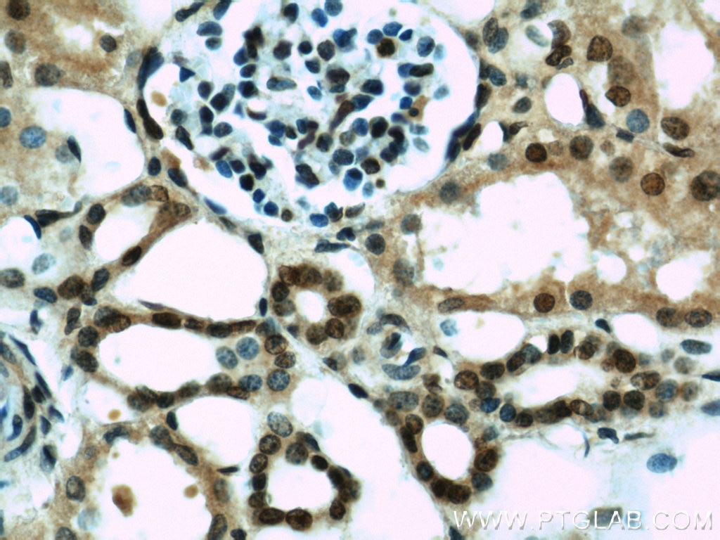 Immunohistochemistry (IHC) staining of human kidney tissue using HIF1a Polyclonal antibody (20960-1-AP)