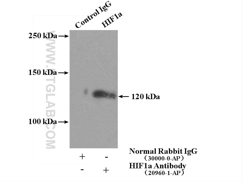 Immunoprecipitation (IP) experiment of HeLa cells using HIF1a Polyclonal antibody (20960-1-AP)