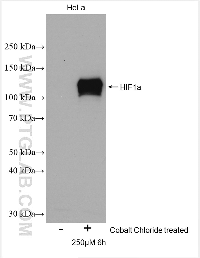 Western Blot (WB) analysis of various lysates using HIF-1 alpha Polyclonal antibody (20960-1-AP)