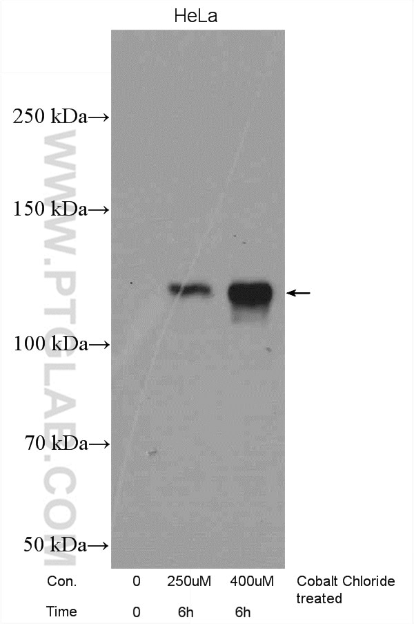 HIF-1 alpha Polyclonal antibody