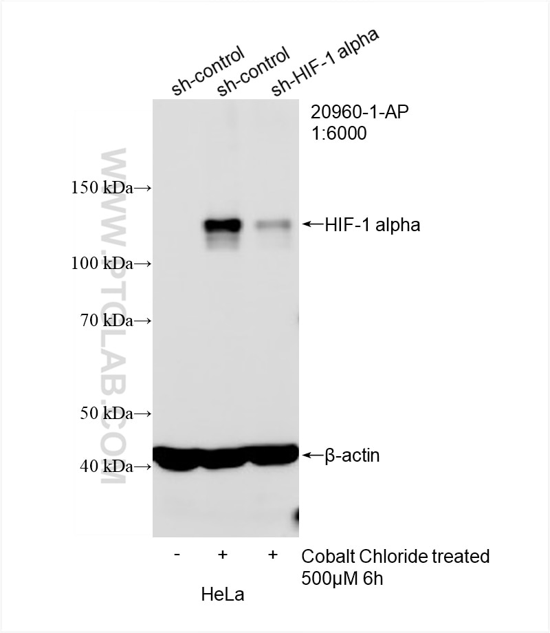 Western Blot (WB) analysis of HeLa cells using HIF-1 alpha Polyclonal antibody (20960-1-AP)