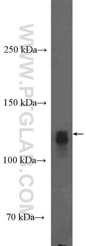 Western Blot (WB) analysis of HeLa cells using HIF1a Polyclonal antibody (20960-1-AP)