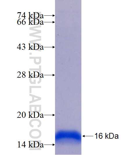 HIF1AN fusion protein Ag25405 SDS-PAGE