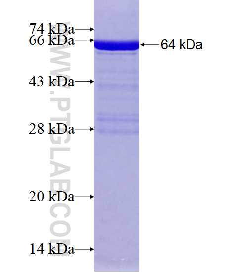 HIF1AN fusion protein Ag0997 SDS-PAGE