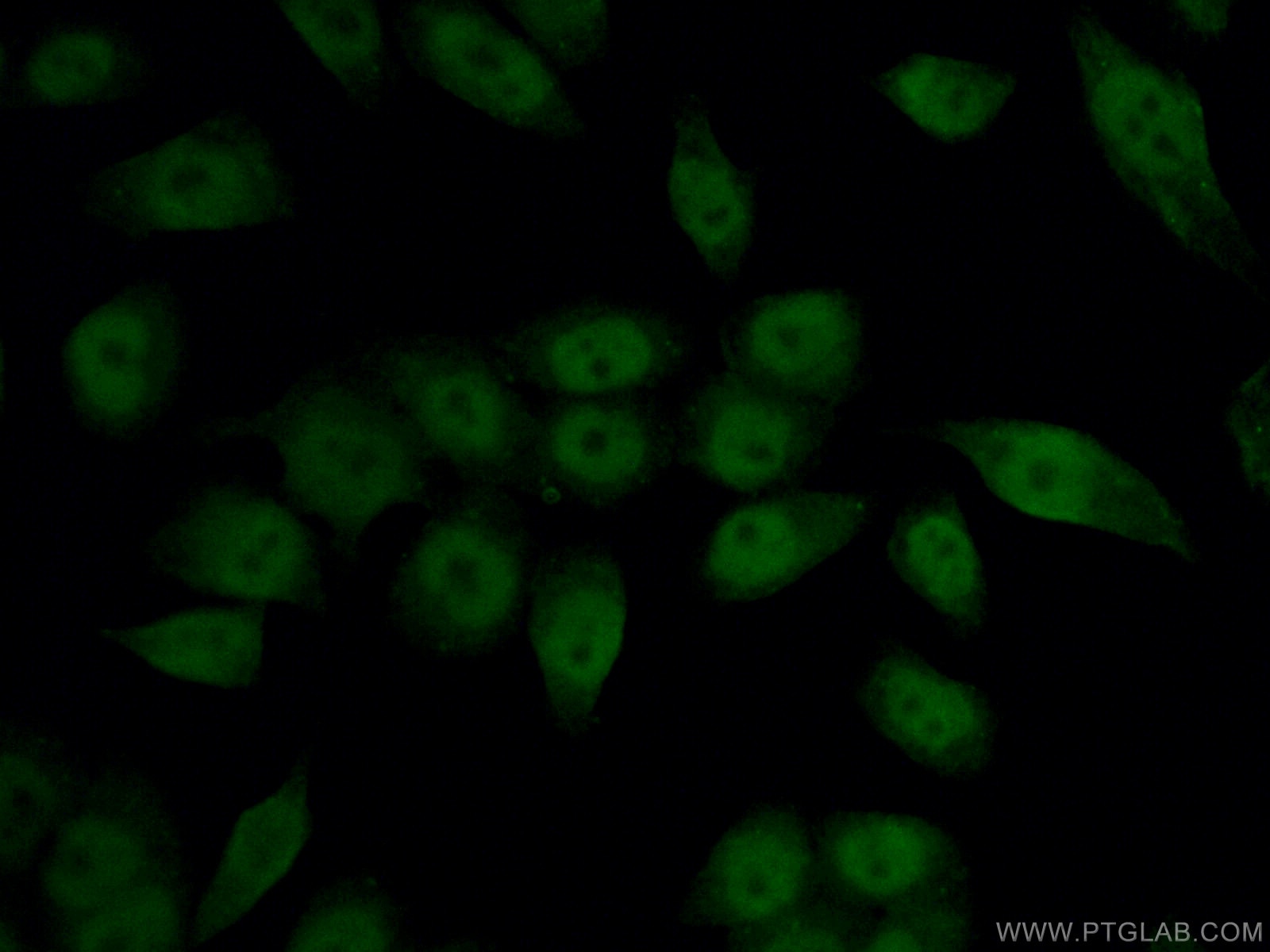 Immunofluorescence (IF) / fluorescent staining of HeLa cells using HIF1a Monoclonal antibody (66730-1-Ig)