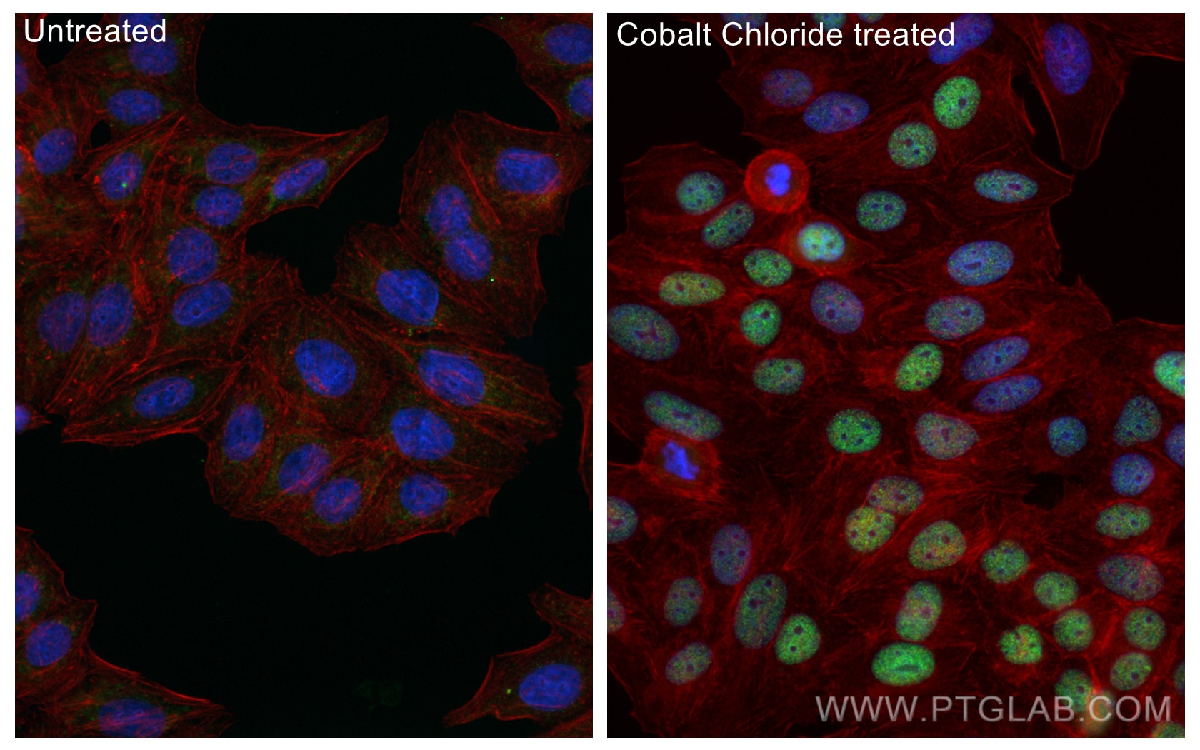 Immunofluorescence (IF) / fluorescent staining of HepG2 cells using HIF1a Recombinant antibody (80933-1-RR)