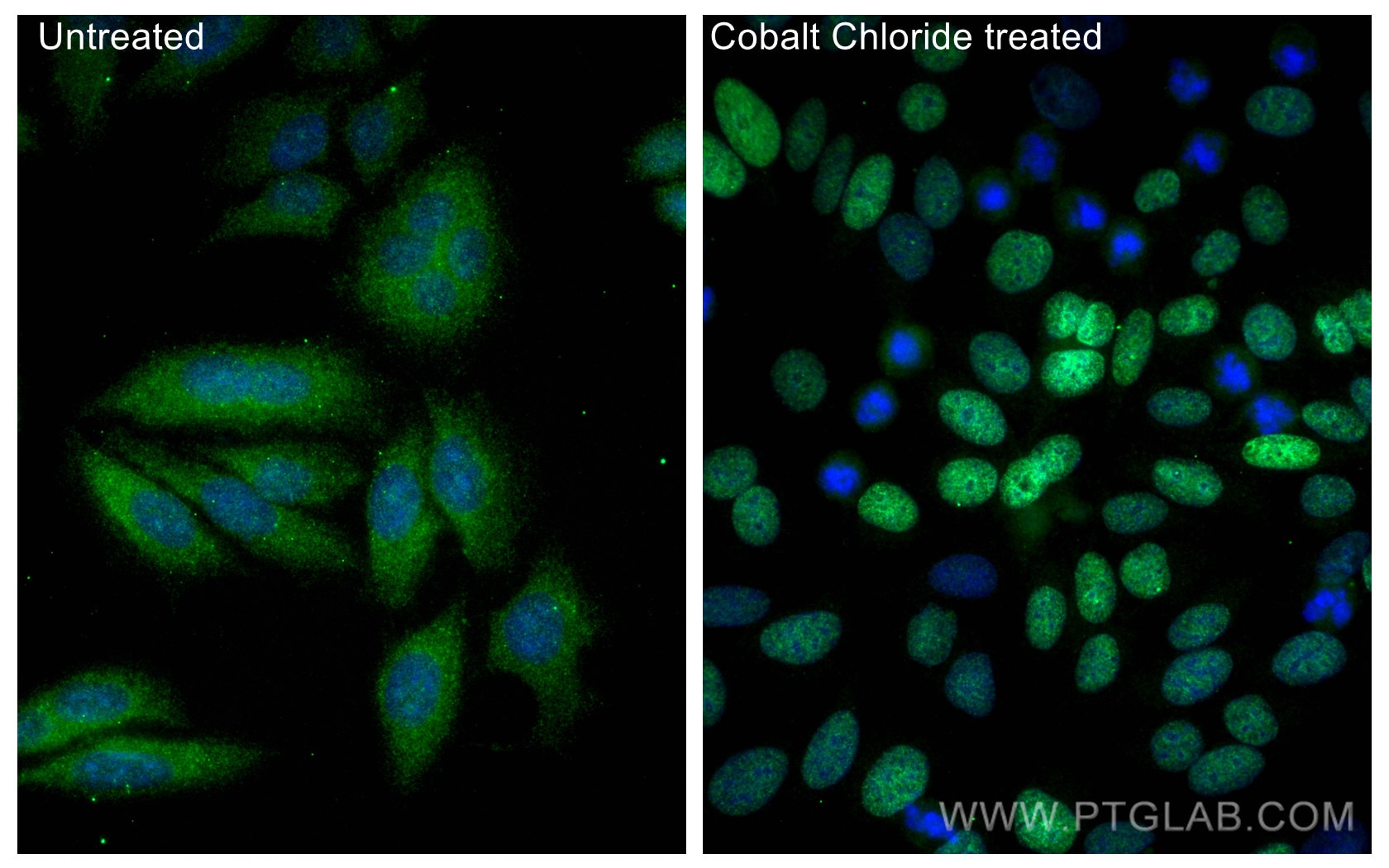 Immunofluorescence (IF) / fluorescent staining of HepG2 cells using HIF-1 alpha Recombinant antibody (80933-1-RR)