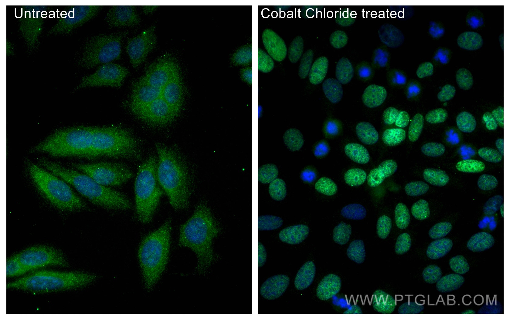 IF Staining of HepG2 using 80933-1-RR