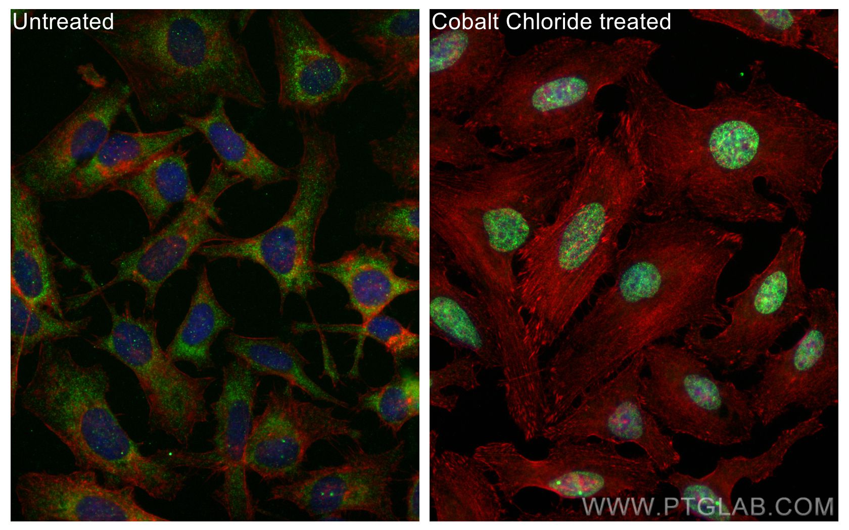 Immunofluorescence (IF) / fluorescent staining of HeLa cells using HIF-1 alpha Recombinant antibody (80933-1-RR)