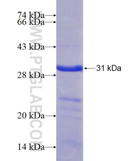 HIF1a fusion protein Ag15632 SDS-PAGE