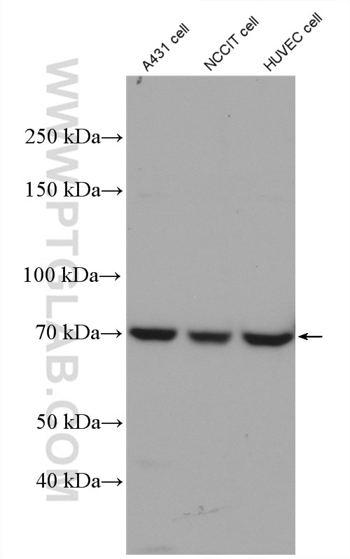 WB analysis of A431 using 27650-1-AP