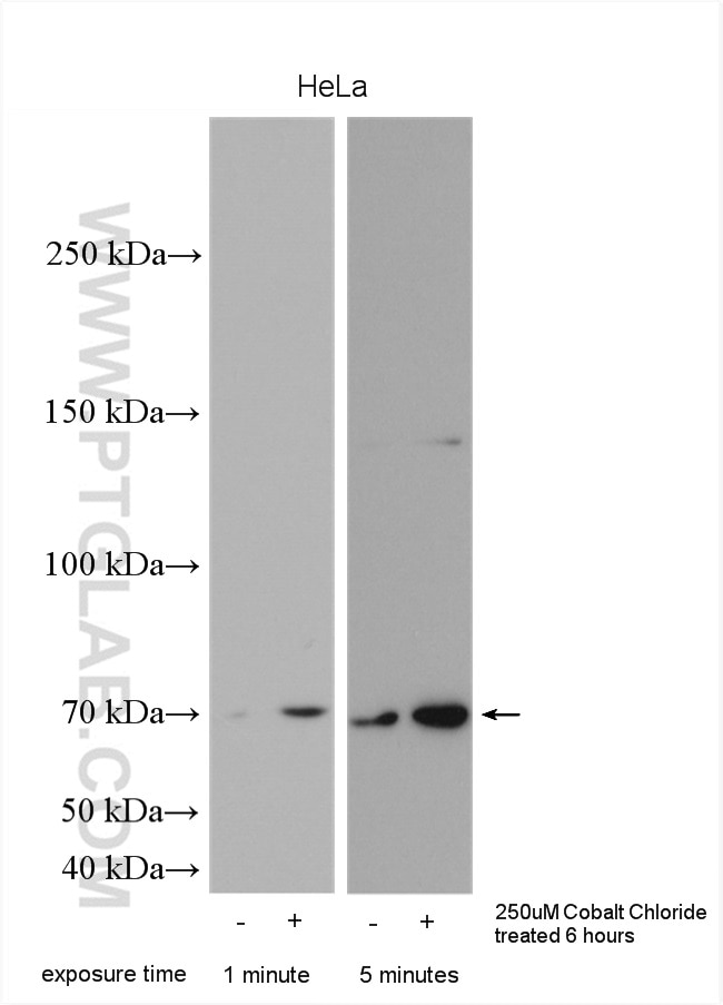 Western Blot (WB) analysis of various lysates using HIF3A Polyclonal antibody (27650-1-AP)