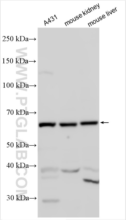 Western Blot (WB) analysis of various lysates using HIF3A Polyclonal antibody (27650-1-AP)