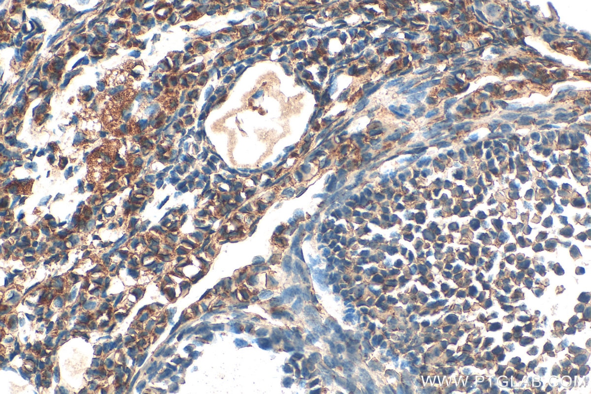 Immunohistochemistry (IHC) staining of mouse ovary tissue using HIGD1A Polyclonal antibody (21749-1-AP)