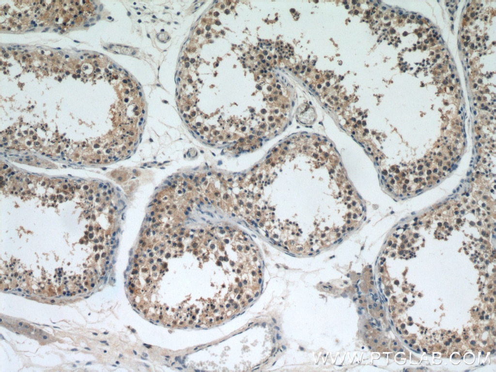 Immunohistochemistry (IHC) staining of human testis tissue using HIGD1A Polyclonal antibody (21749-1-AP)