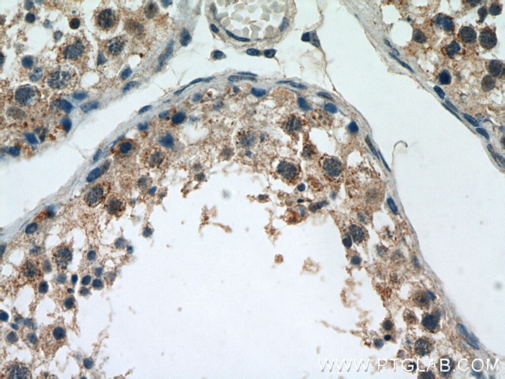 Immunohistochemistry (IHC) staining of human testis tissue using HIGD1A Polyclonal antibody (21749-1-AP)