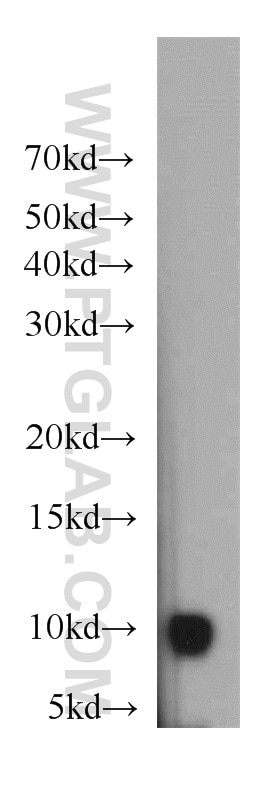 Western Blot (WB) analysis of HeLa cells using HIGD1A Polyclonal antibody (21749-1-AP)