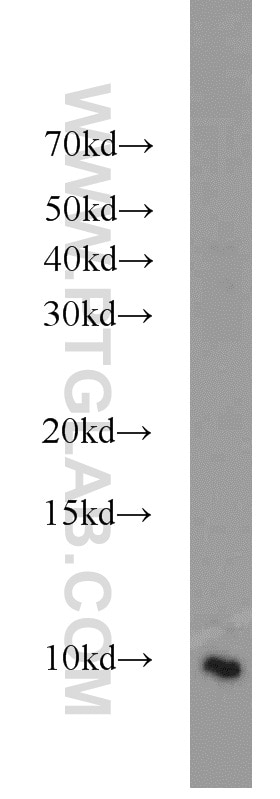 Western Blot (WB) analysis of rat brain tissue using HIGD1A Polyclonal antibody (21749-1-AP)