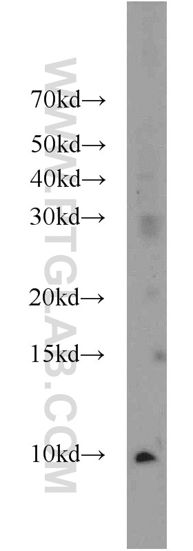 Western Blot (WB) analysis of rat kidney tissue using HIGD1A Polyclonal antibody (21749-1-AP)