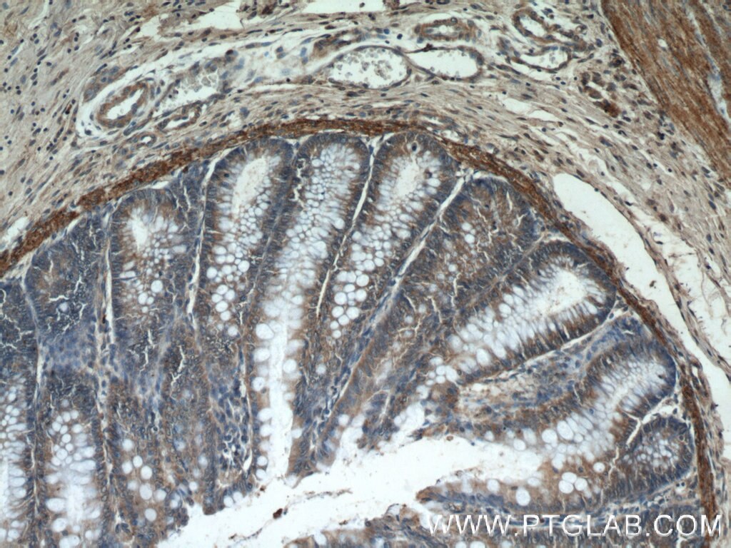 Immunohistochemistry (IHC) staining of human colon tissue using HIGD1B Polyclonal antibody (25367-1-AP)