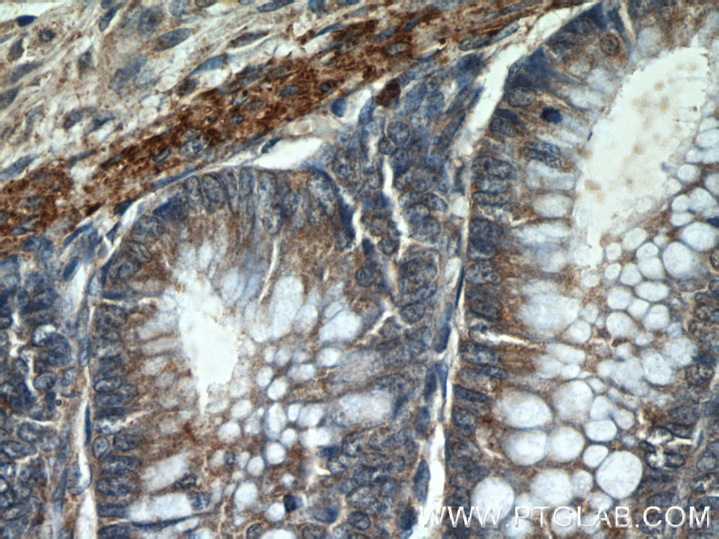 Immunohistochemistry (IHC) staining of human colon tissue using HIGD1B Polyclonal antibody (25367-1-AP)