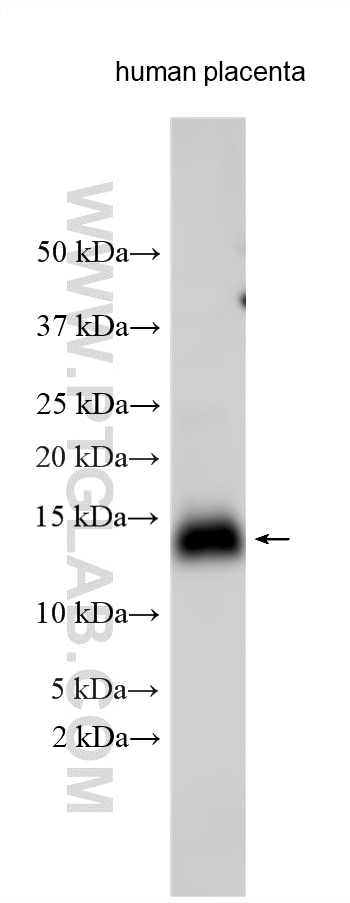 Western Blot (WB) analysis of various lysates using HIGD1B Polyclonal antibody (25367-1-AP)