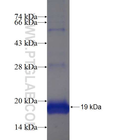 HIGD1B fusion protein Ag21871 SDS-PAGE