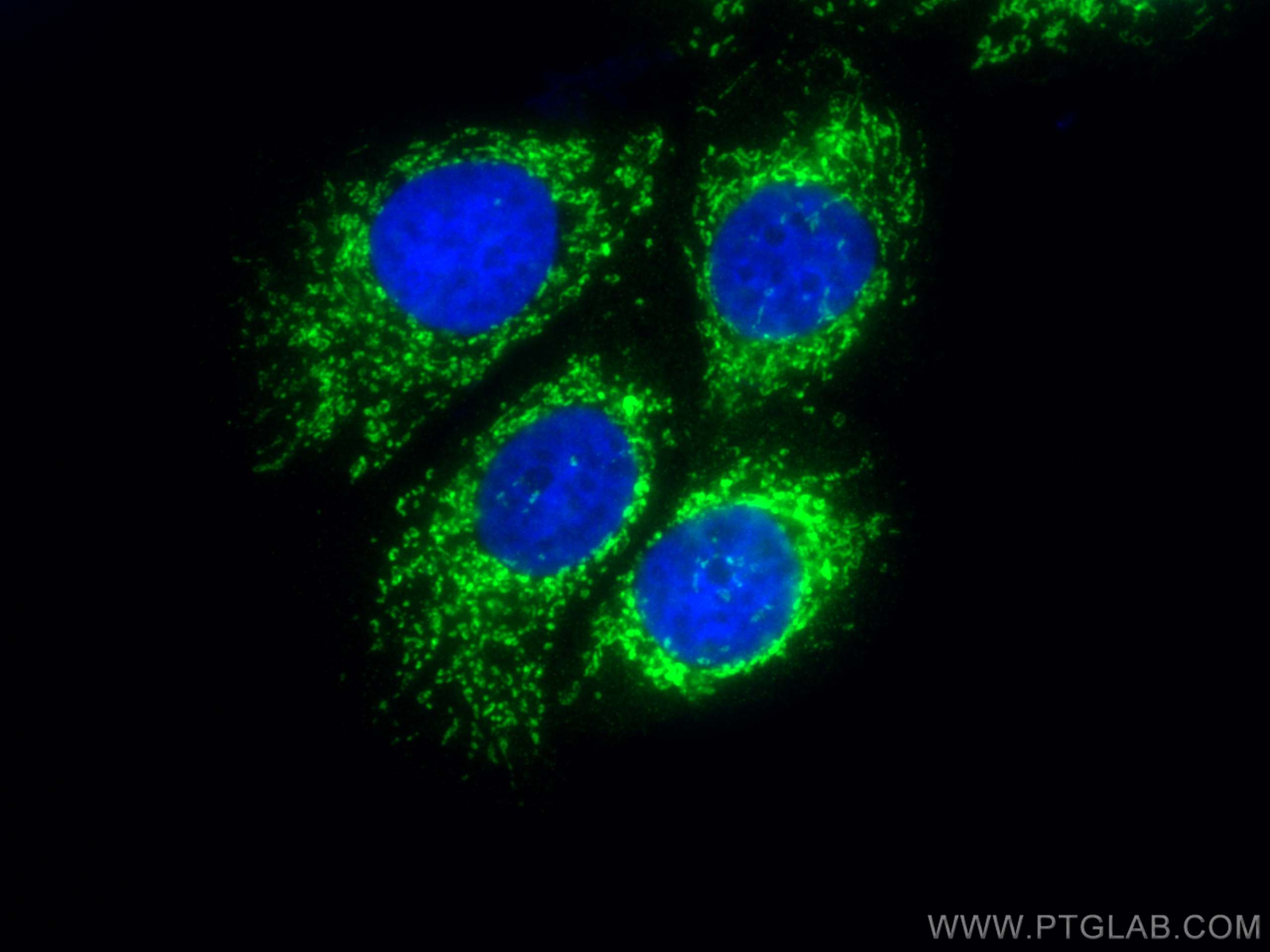 Immunofluorescence (IF) / fluorescent staining of MCF-7 cells using HIGD2A Polyclonal antibody (21415-1-AP)