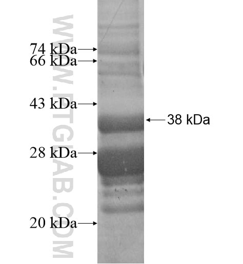 HIGD2A fusion protein Ag15892 SDS-PAGE