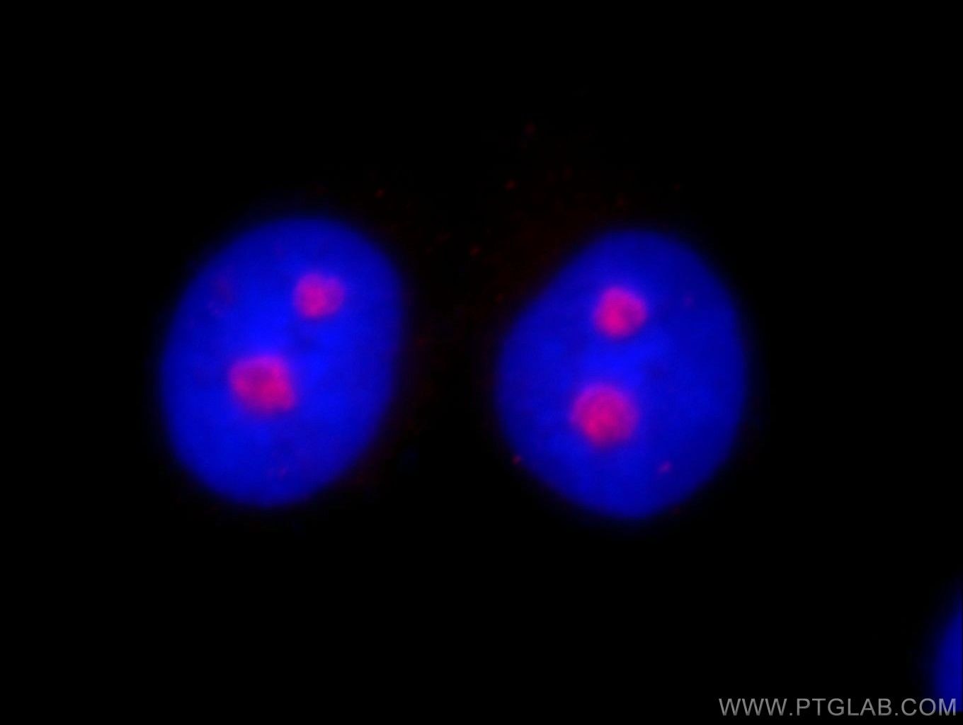 IF Staining of HeLa using 10066-2-AP