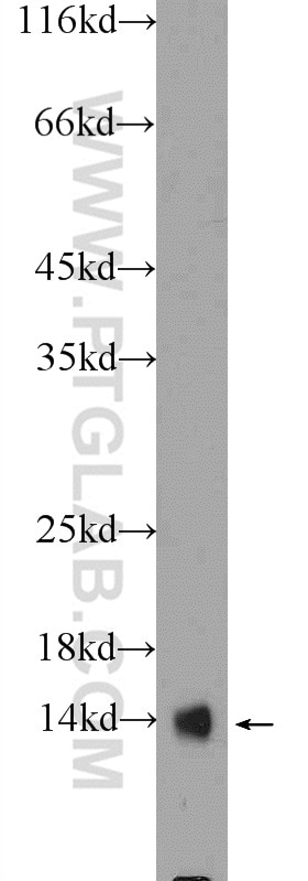 Western Blot (WB) analysis of rat brain tissue using HINT1 Polyclonal antibody (10717-1-AP)