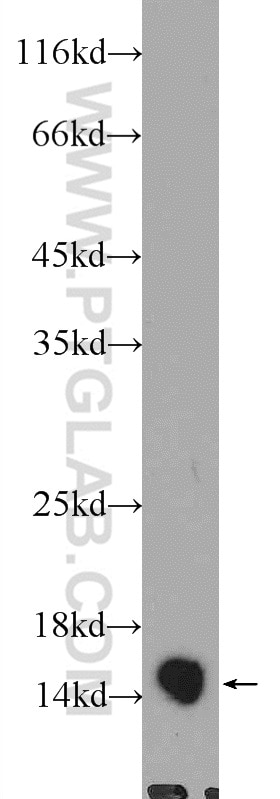 WB analysis of rat thymus using 10717-1-AP