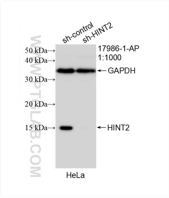 Western Blot (WB) analysis of HeLa cells using HINT2 Polyclonal antibody (17986-1-AP)