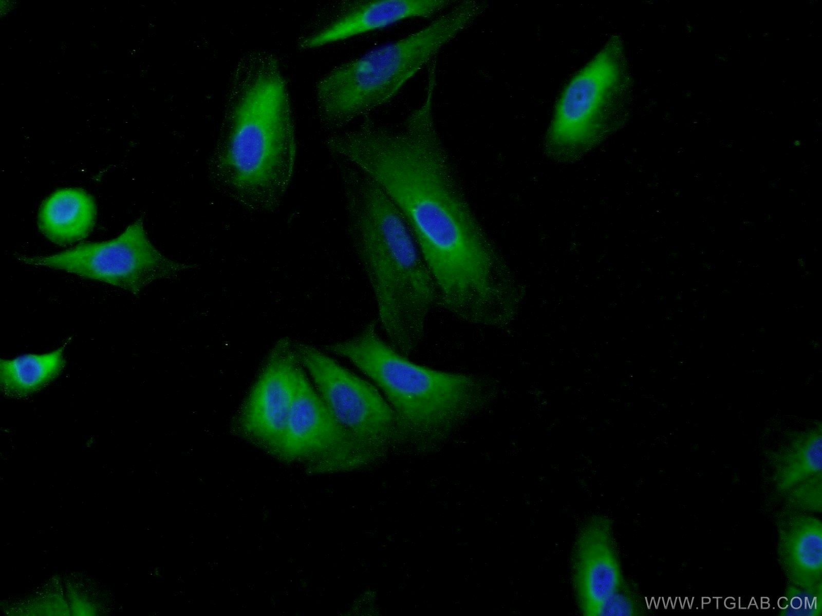 Immunofluorescence (IF) / fluorescent staining of A549 cells using HIP1 Polyclonal antibody (22231-1-AP)