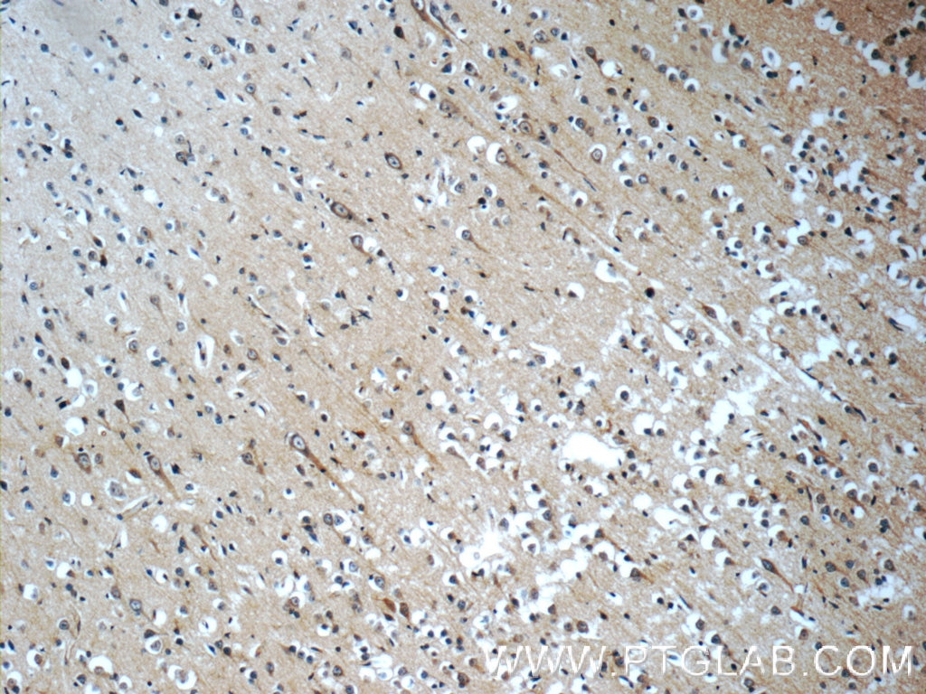 Immunohistochemistry (IHC) staining of human brain tissue using HIP1 Polyclonal antibody (22231-1-AP)