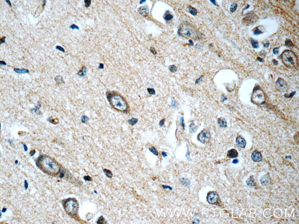 IHC staining of human brain using 22231-1-AP