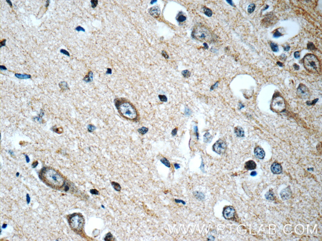 Immunohistochemistry (IHC) staining of human brain tissue using HIP1 Polyclonal antibody (22231-1-AP)