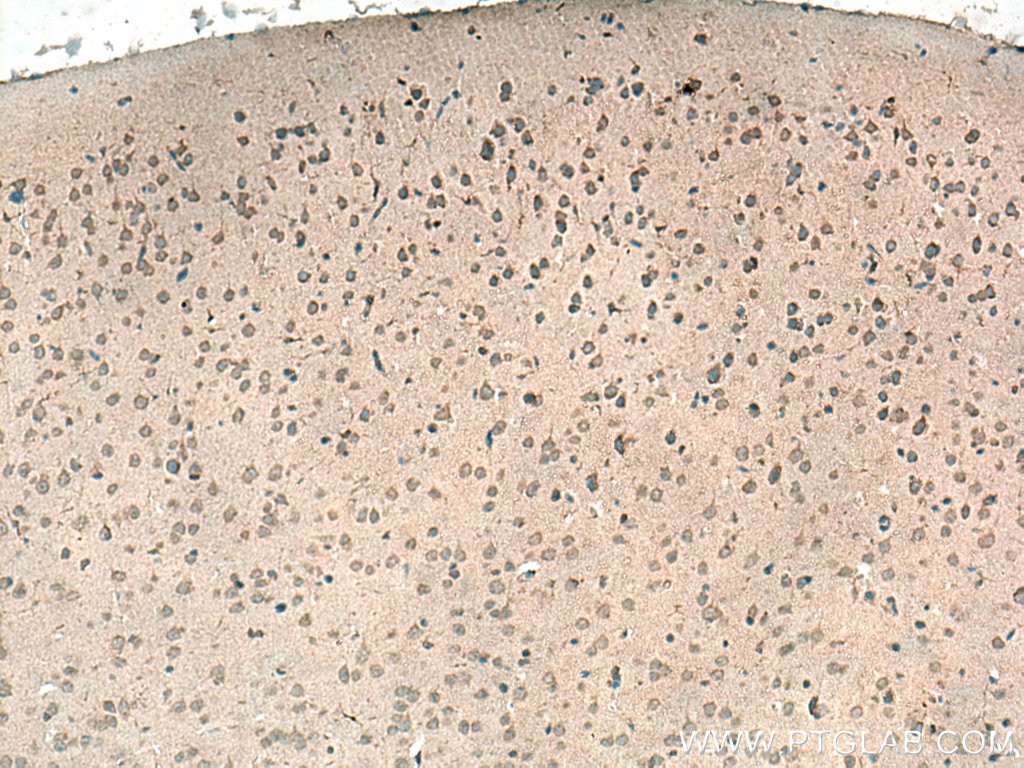 IHC staining of mouse brain using 22231-1-AP