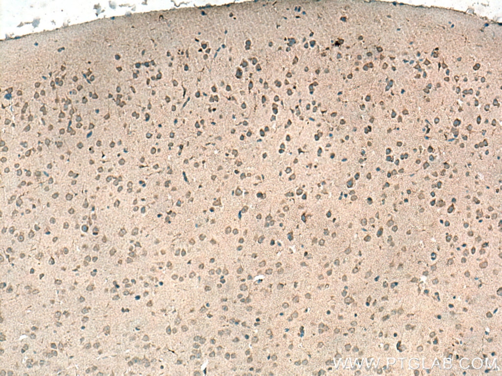 Immunohistochemistry (IHC) staining of mouse brain tissue using HIP1 Polyclonal antibody (22231-1-AP)