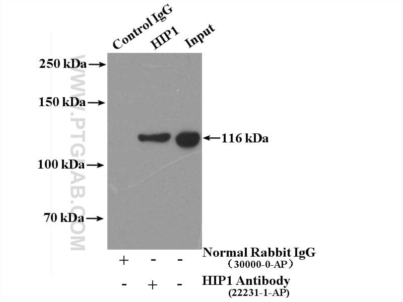 Immunoprecipitation (IP) experiment of HeLa cells using HIP1 Polyclonal antibody (22231-1-AP)