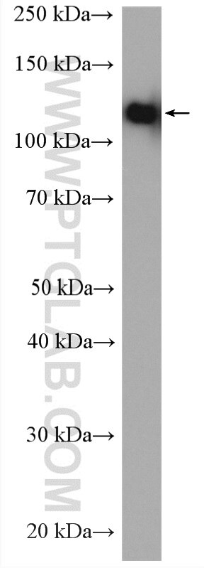 WB analysis of PC-3 using 22231-1-AP